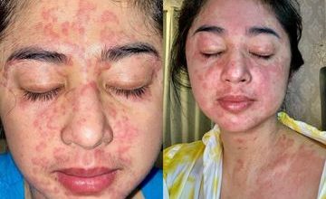 Photo of Dewi Perssik: Telanjang Salah, Gak Telanjang Gatal